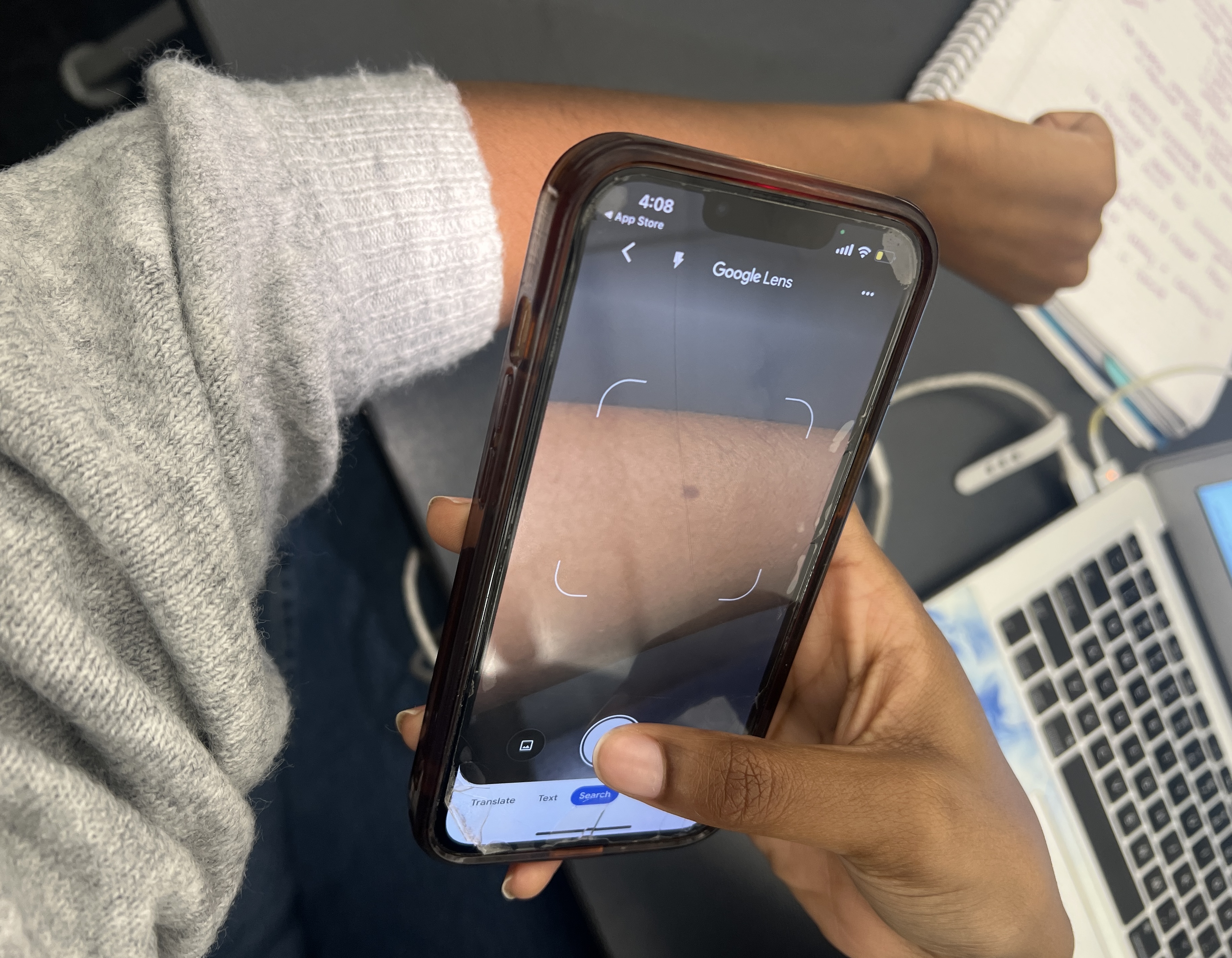 an app that diagnoses skin conditions